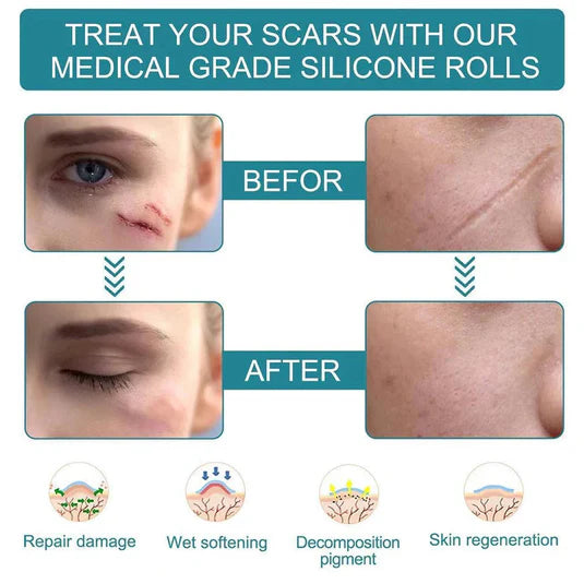 Scar Repair
